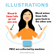 PBSC